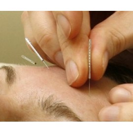 Aguja acupuntura con guía